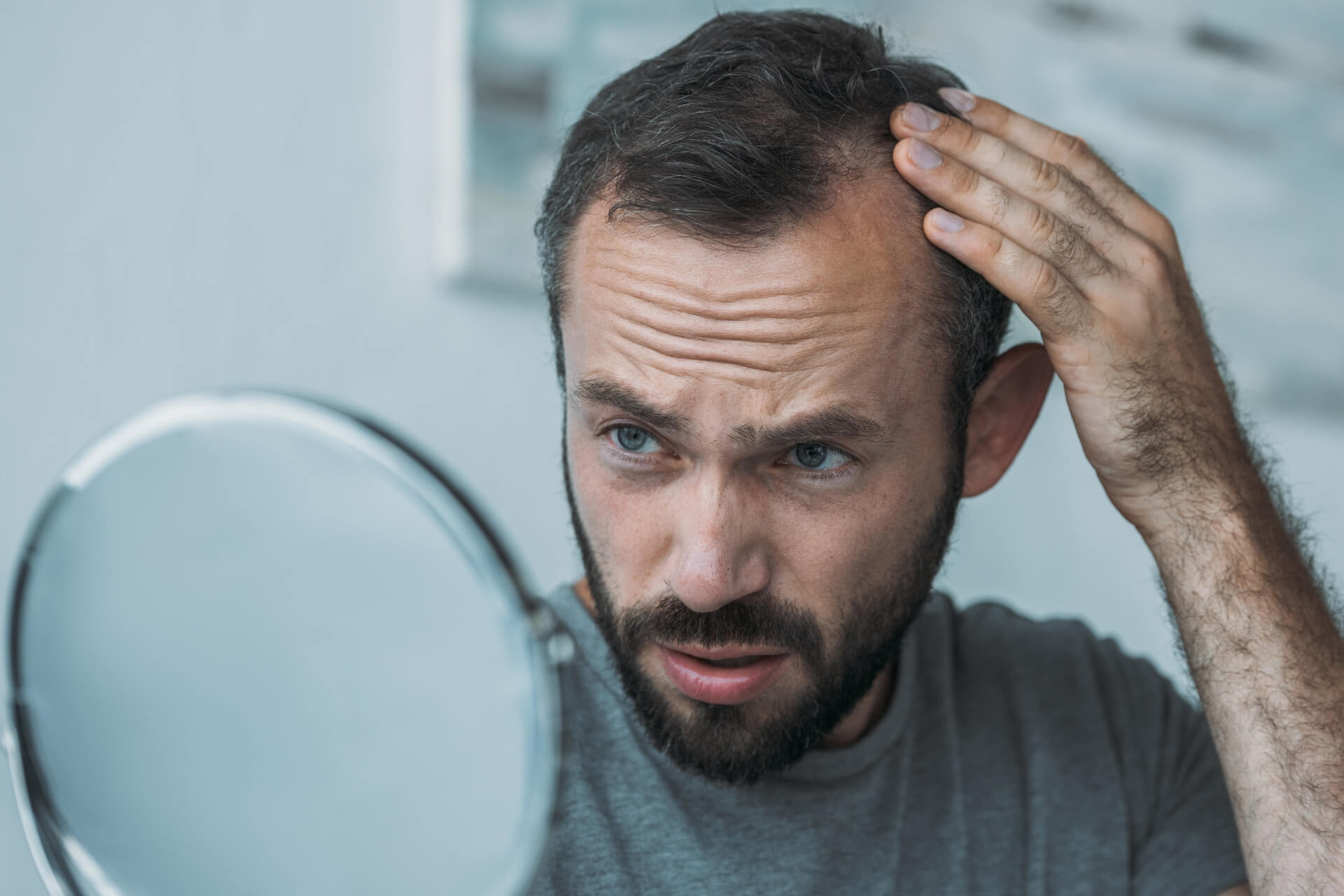 terapia per perdita di capelli bassano del grappa vicenza